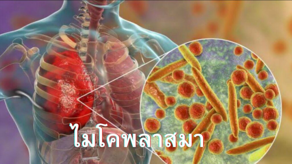 ไมโคพลาสมา